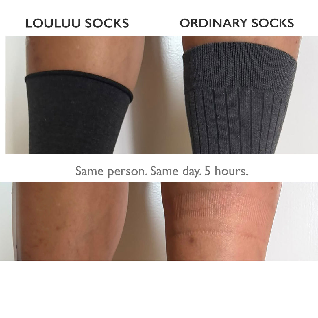 Louluu No-Mark sock versus an ordinary sock after five hours — the ordinary sock's ribbed band has left a clear imprint on the right leg, while the leg that wore the Louluu sock is unmarked